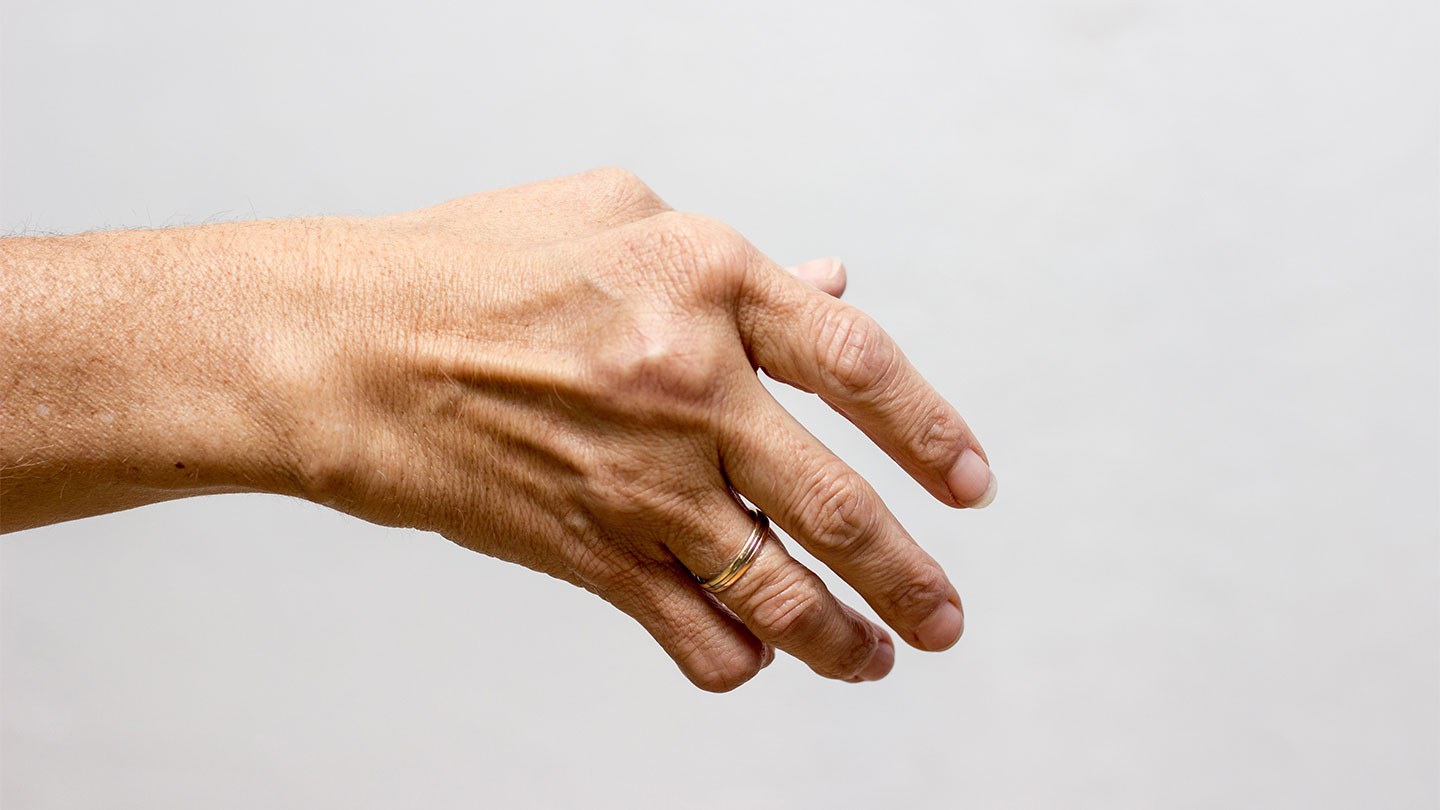 Rheuma finger